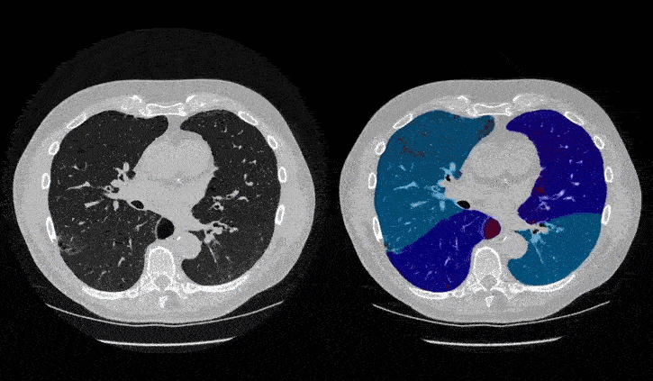project thumbnail