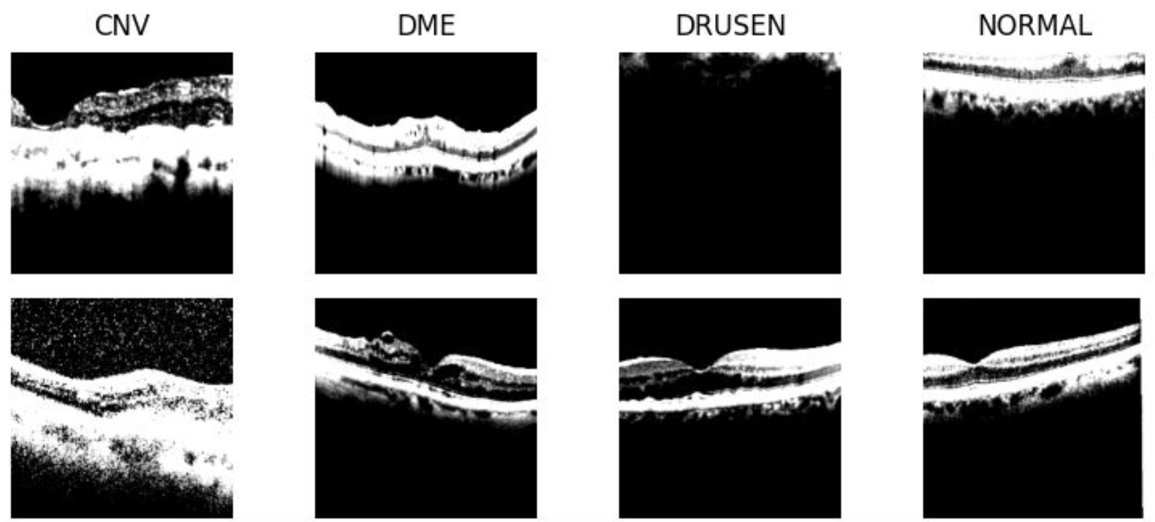 OCT Scan Class Visualization