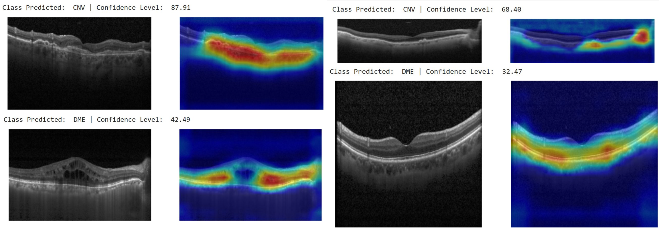 Grad-CAM Saliency Mapping